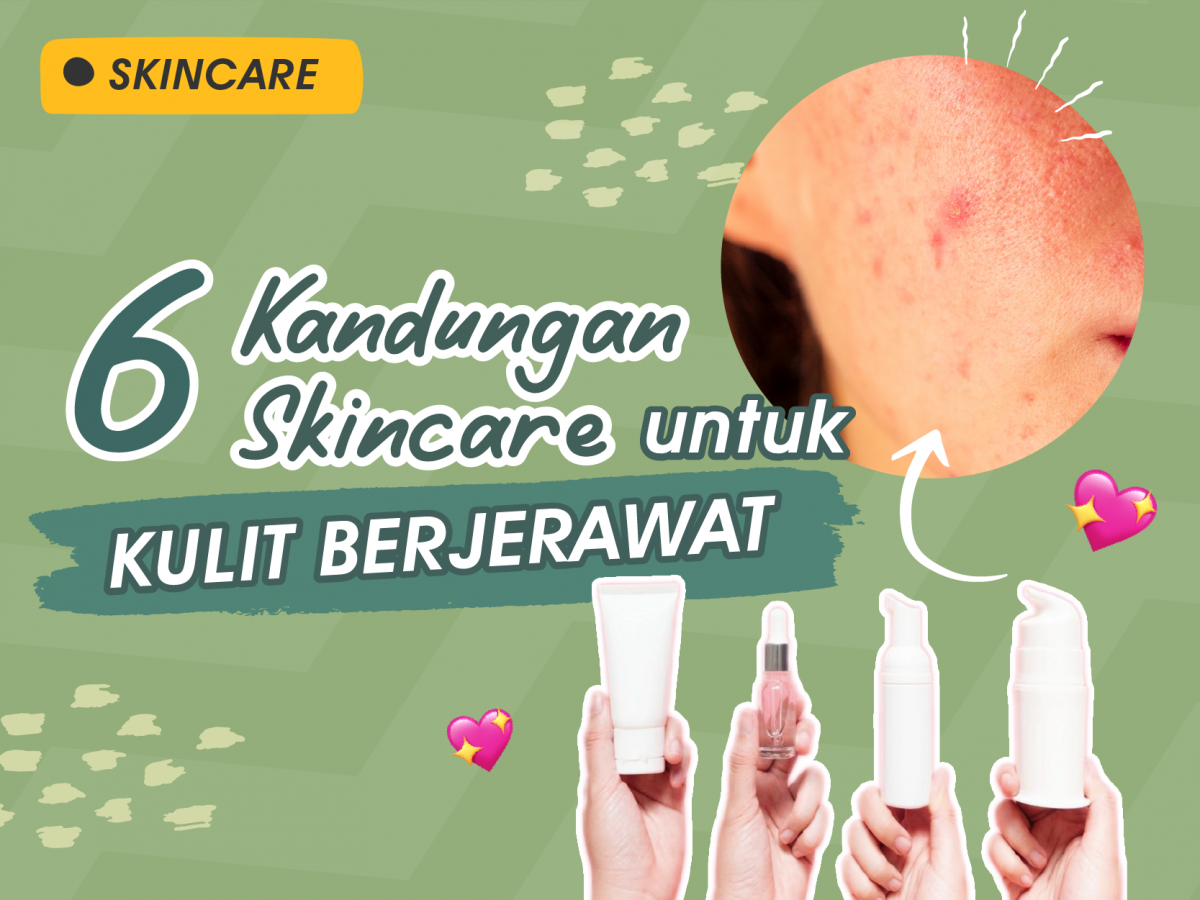 6 Kandungan Skincare Untuk Kulit Berjerawat | HEYSTETIK - Heystetik