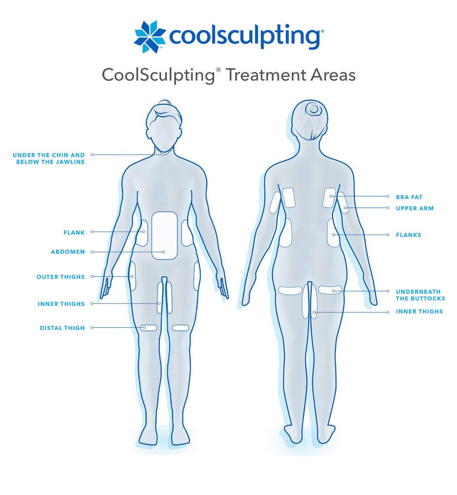 Coolsculpting-treatmentareas