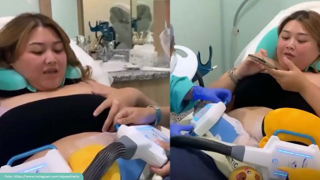 Clarissa Putri Menjalani Perawatan Cryolipolysis