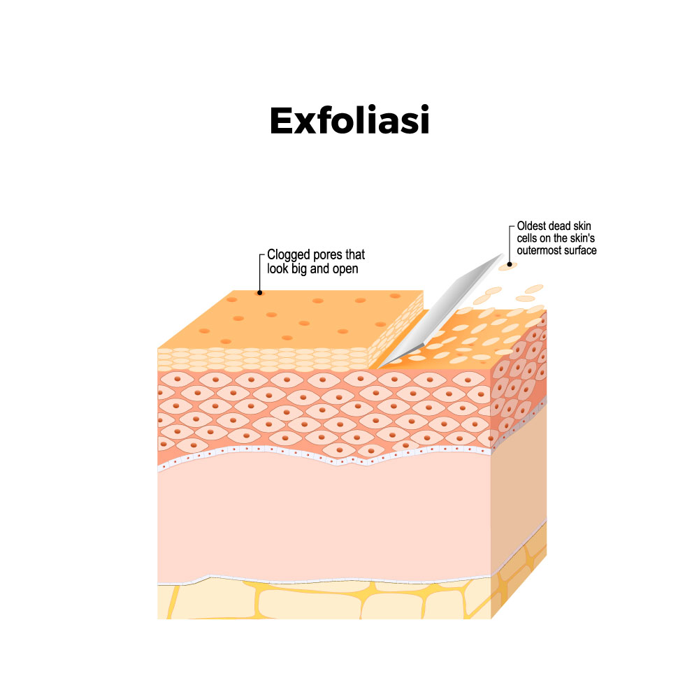 eksfoliasi kulit dengan mikrodermabrasi